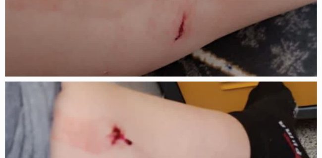 حمله سگ بی سرپناه به دختر ۲۰ سال اهل پرند / راهی برای حذف دائمی سگ‌ها از محله‌ها وجود دارد؟