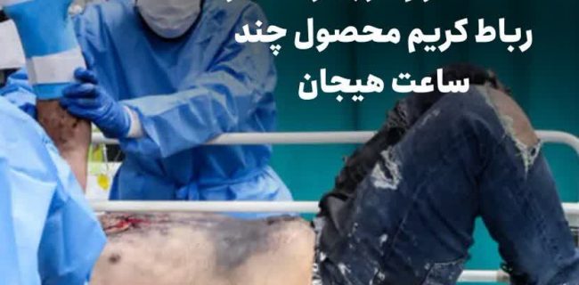 گزارش رئیس اورژانس از حوادث چهارشنبه سوری: ۴۶ مصدوم در بهارستان و رباط کریم محصول چند ساعت هیجان