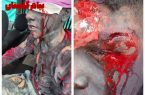 نخستین حادثه گلستان در سال ۱۴۰۴ رقم خورد / مصدومیت یک عابر پیاده بی‌گناه بر اثر پرتاب ترقه!