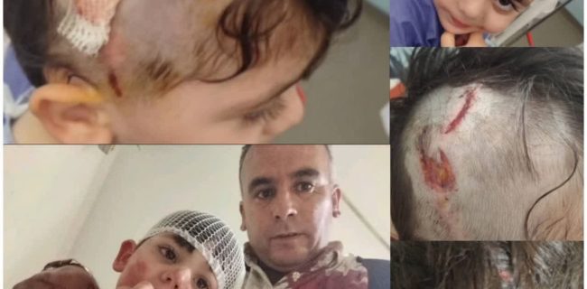 حمله سگ ولگرد به کودک ۳ ساله در پرند / حامیان سگها، این تصویر را ببینید!